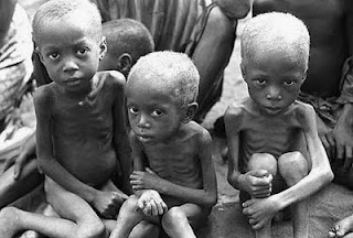 Three starving African boys.