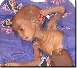 African boy dying of hunger.