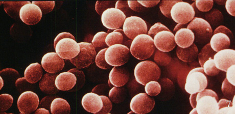 An electron micrograph showing Staphylococcus aureus.