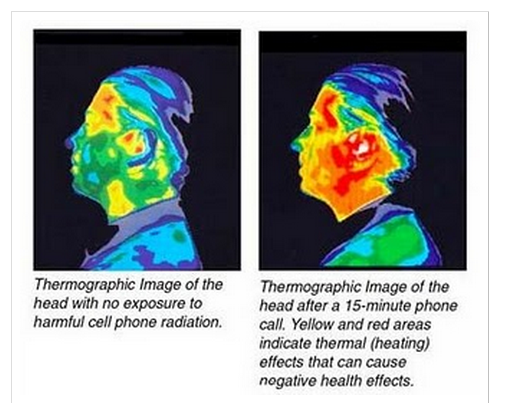 The Negative Impact of Cell Phone Exposure.