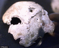 Hitler’s skull at a Russian archive