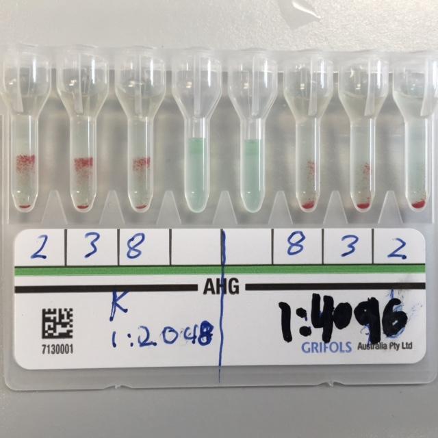 Anti-K antibodies Gel Card test