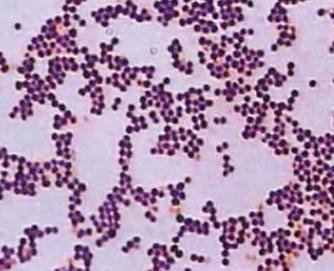  Staining results reveal that S. aureus is Gram-positive bacteria.