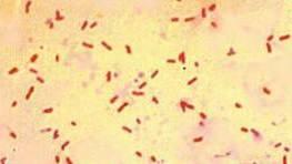 Staining results make it clear that E. coli is Gram-negative.