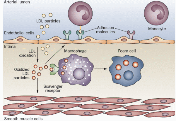 Dyslipidemia, represented by LDL particles, induces the endothelial injury.