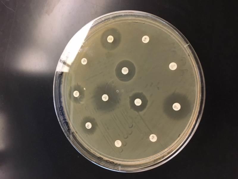 Petri dishes indicating zones of inhibition of different bacteria growing on media impregnated by antibiotic discs. 