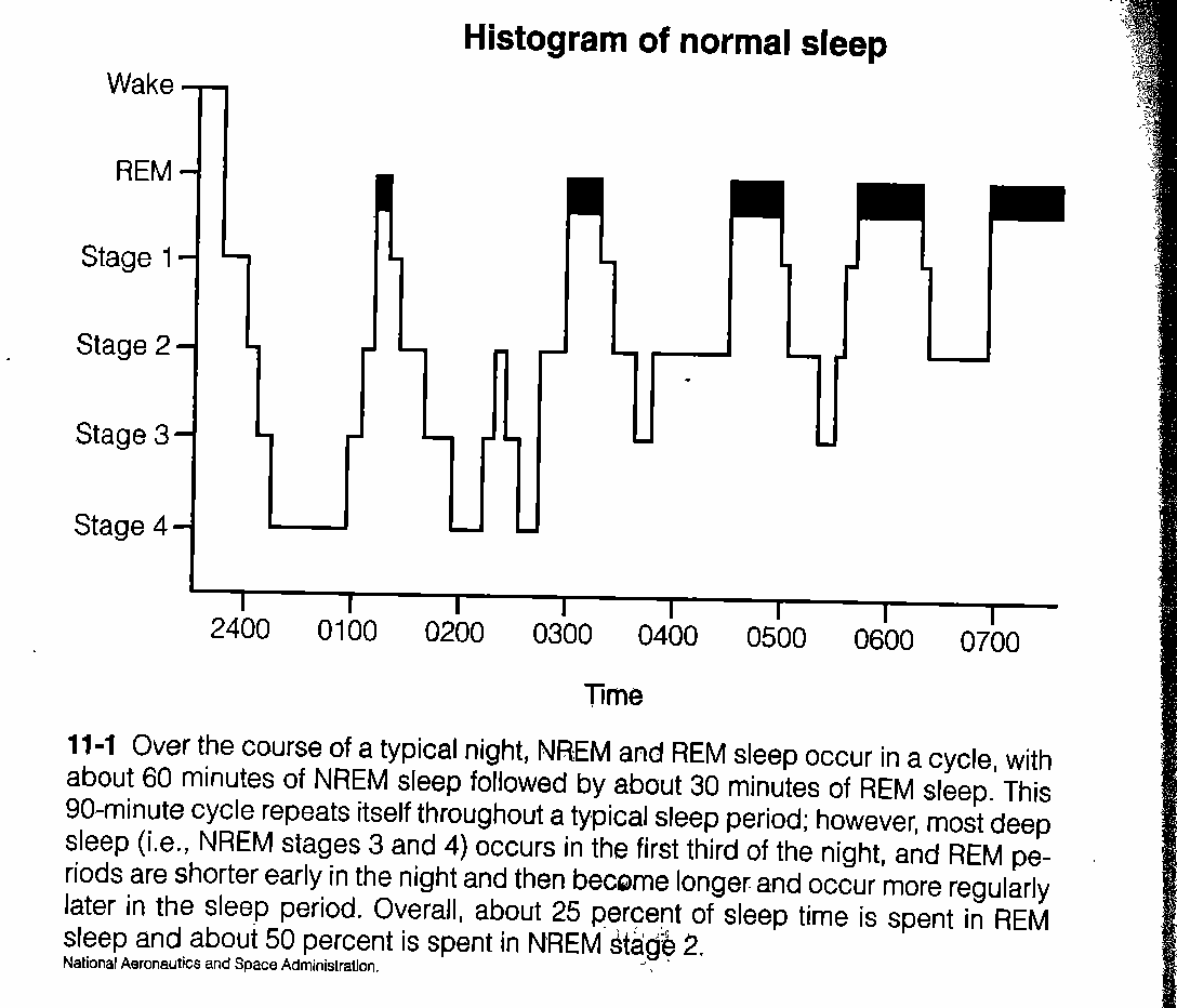 Histogram of normal sleep