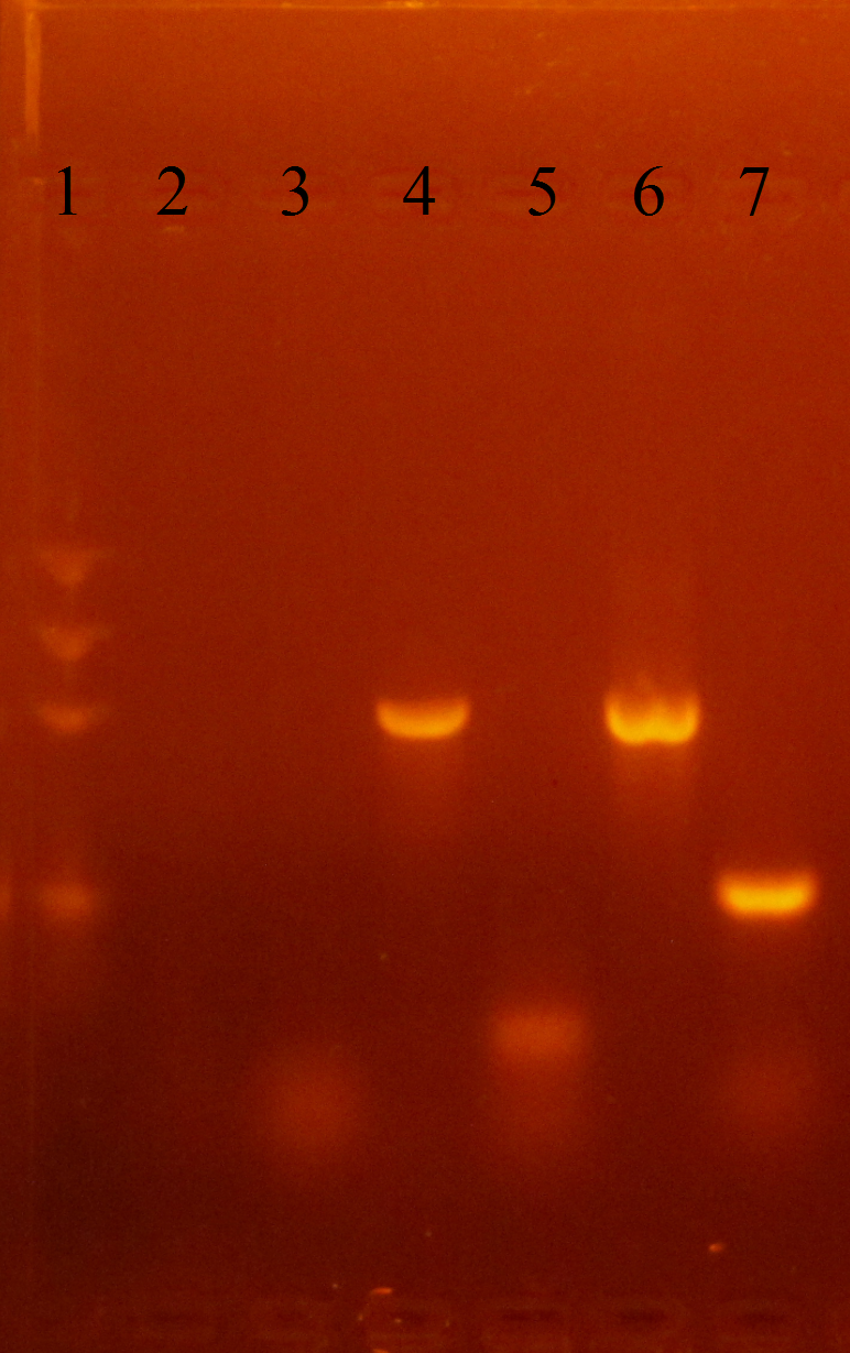 The results of the agarose gel electrophoresis.