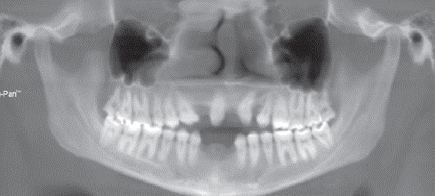  Dental Panoramic Tomography