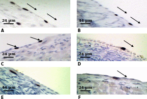 Photomicrographs showing BrdU labelling labeling within the marmoset OSE cells.