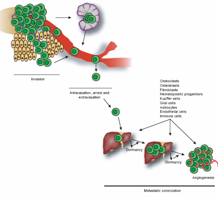 The tumour metastatic process (from Steeg, 2006)
