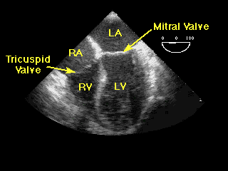 Typical echocardiogram image.