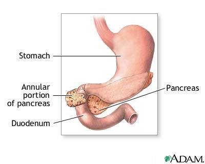 An annular pancreas.