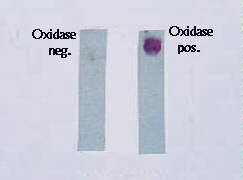 Oxidase test.