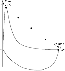 a typical concave flow loop looks appears