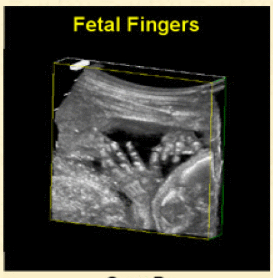 fetal fingers.