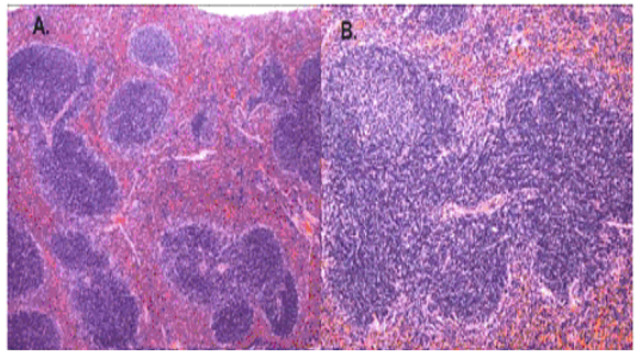 Normal histological structure of the spleen tissue