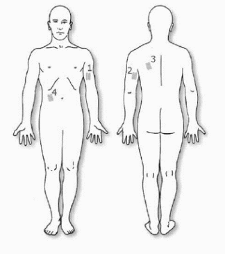 Taking skinfold measurement (by Harpender manual)
