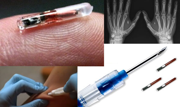 Example of RFID Chip Location and Method of Insertion
