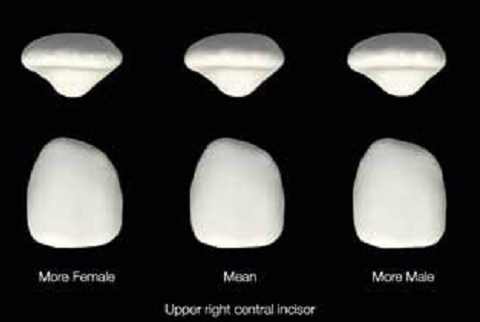 “Top view and frontal view of the female, mean and male shape variations for the standardized maxillary right central incisor”