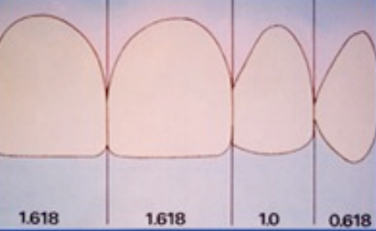 An illustration of the golden proportion that is a prerequisite for an aesthetic smile 