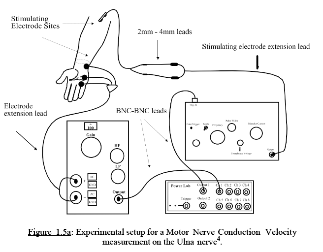 A diagram showing the set-up that was used to measure motor nerve conduction.