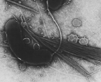 Electron microscopic image of Vibrio cholera Thaker