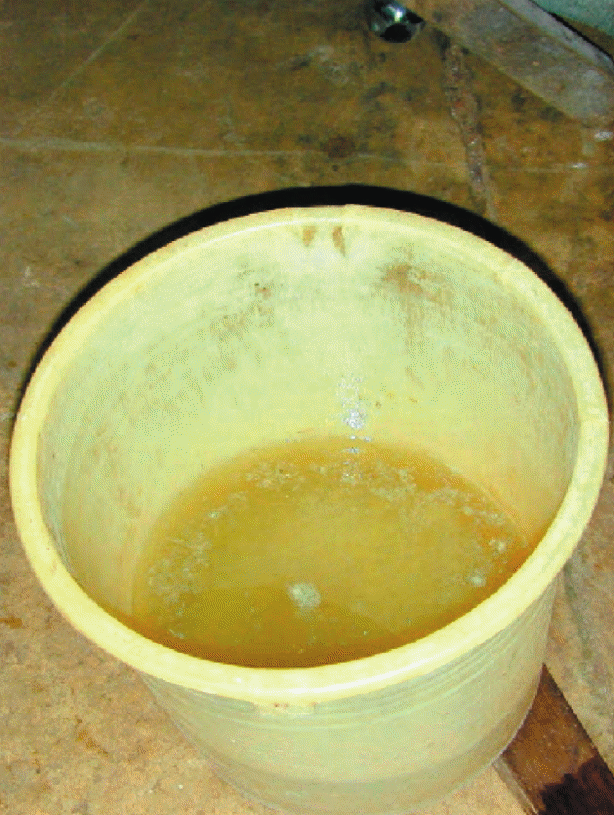 A bucket with typical rice stool from a cholera patient