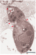 Toxoplasma Gondii 