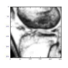 MRI image, Gaussian filter, standard deviation=13