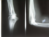 lateral and front radiographs