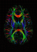 An MRI Image.