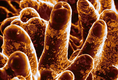 Bacteria biofilm attached to intestinal surface [Biofilm attached to the inner walls of the intestines, creating a layer around mucus of the colon walls 400x272]. Source: Katragkou, Roilides, Walsh (28).