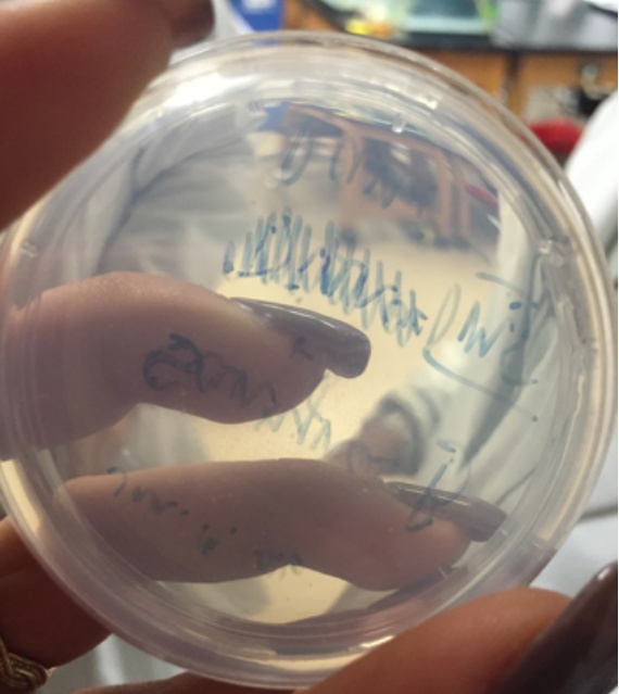Spores spread on the media in the Petri dish