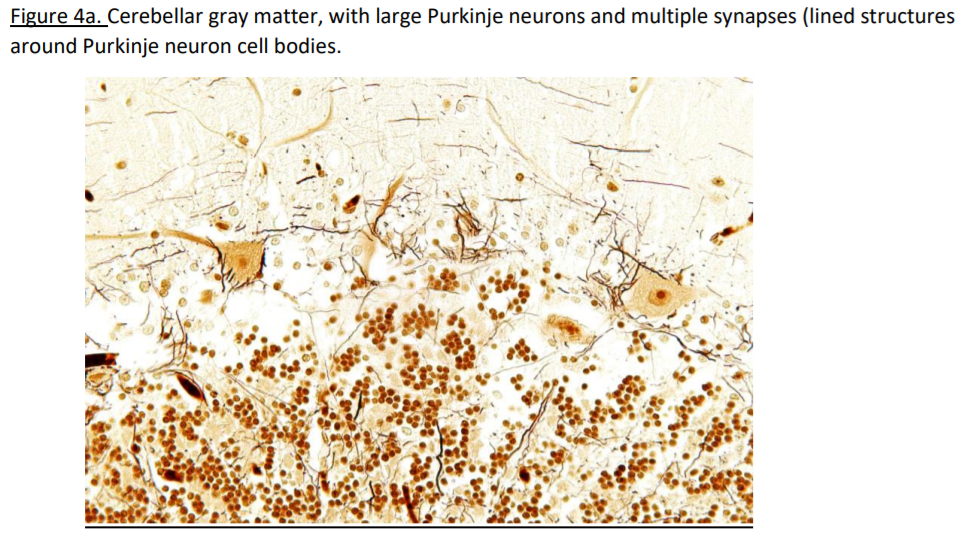 Cerebellar gray matter, with Purkinje neurons and multiple synapses