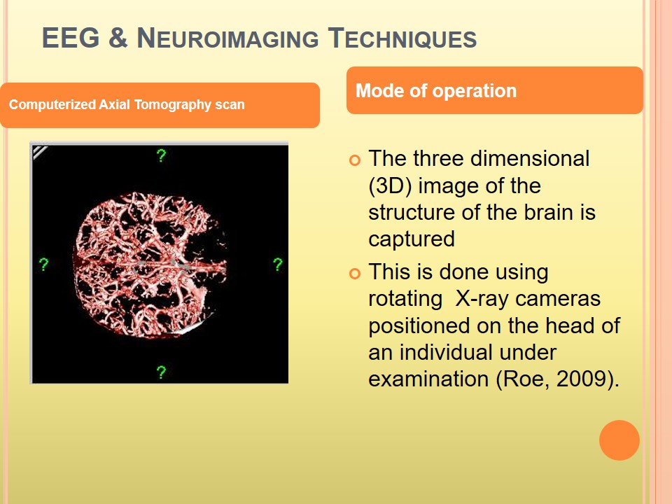 Computerized Axial Tomography scan