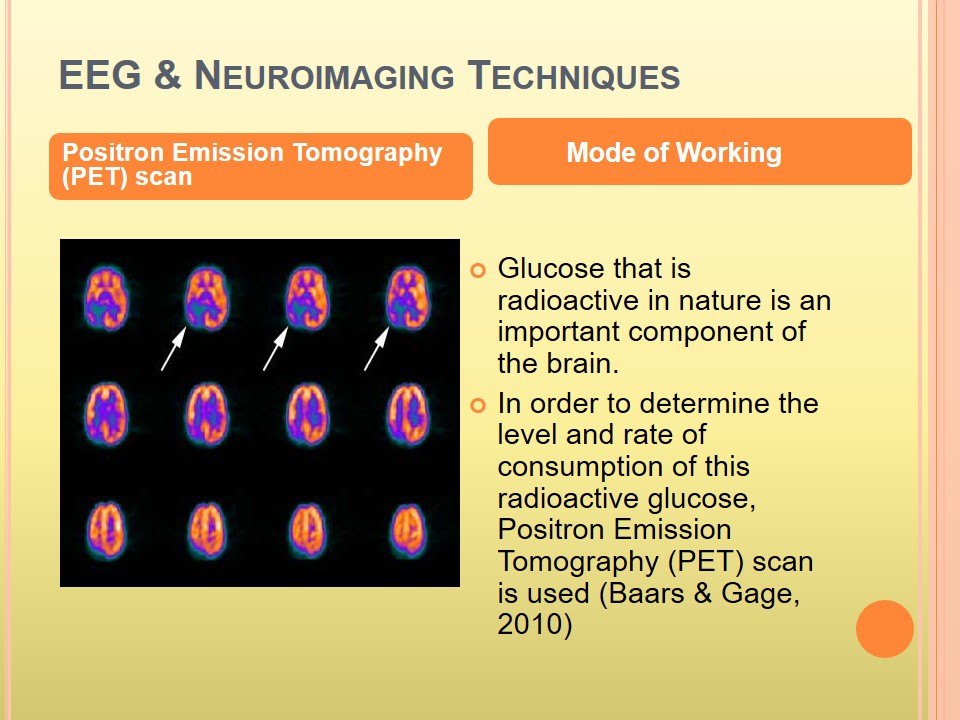 Positron Emission Tomography (PET) scan