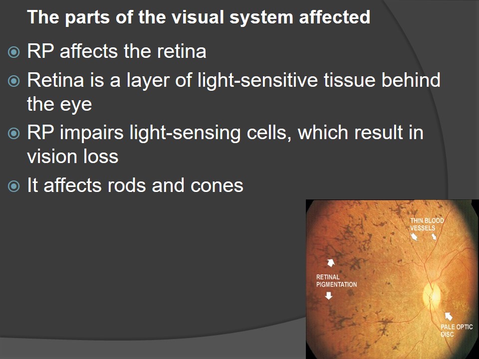 The parts of the visual system affected