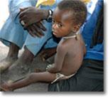 World vision photos are of children receiving food
