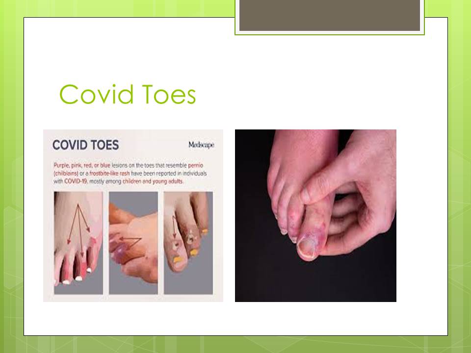 Covid Toes