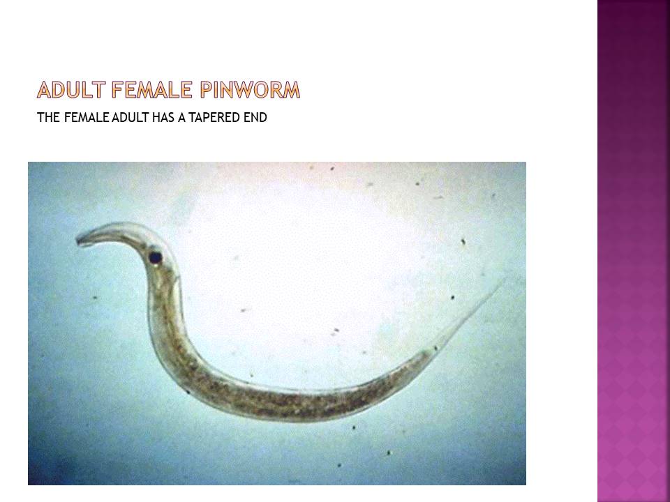 Adult female pinworm. The female adult has a tapered end