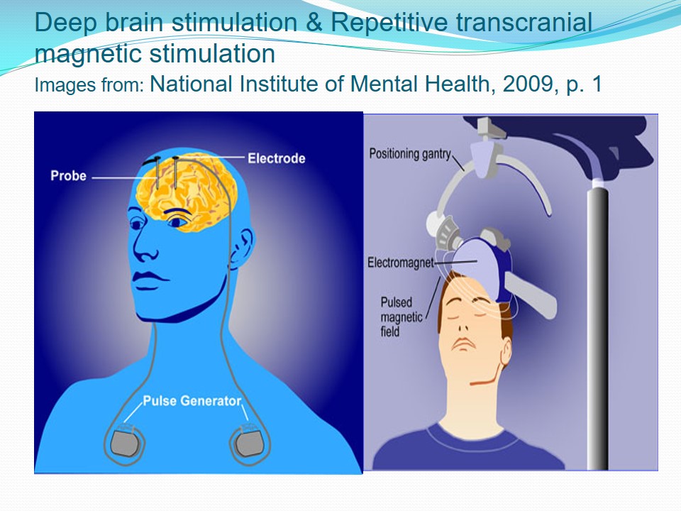 Deep brain stimulation & Repetitive transcranial magnetic stimulation