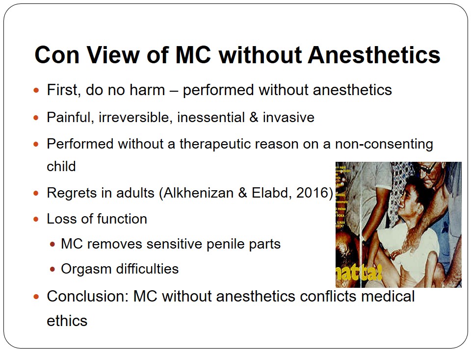 Con View of MC without Anesthetics