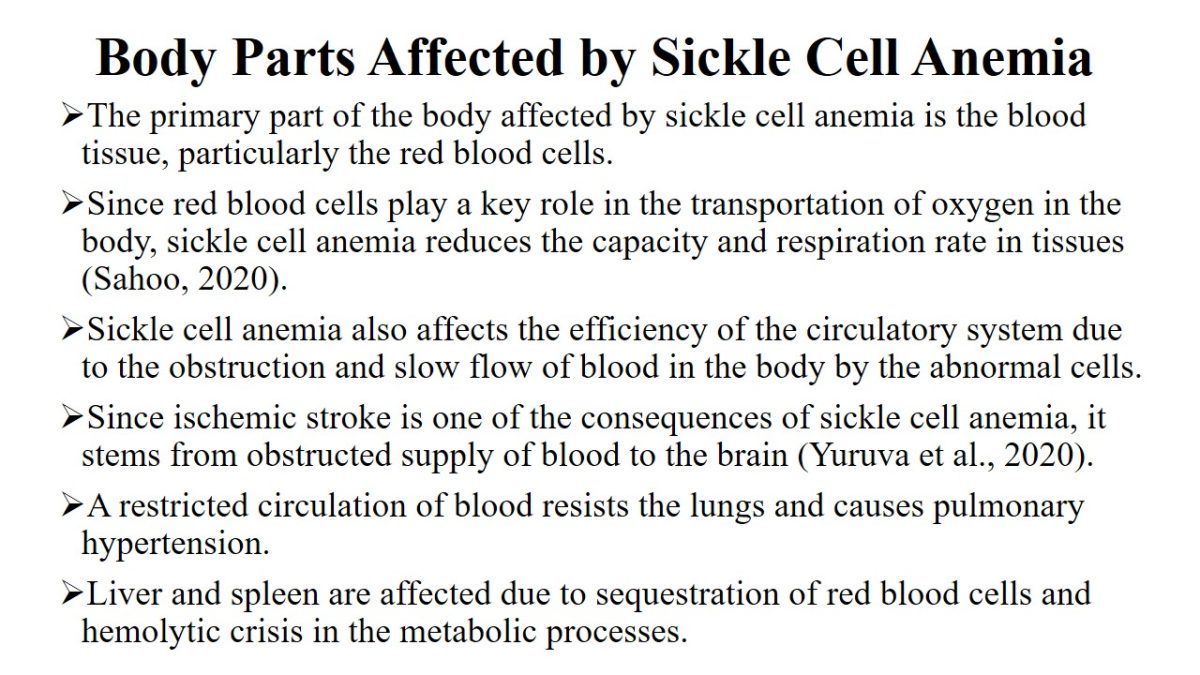 Body Parts Affected by Sickle Cell Anemia