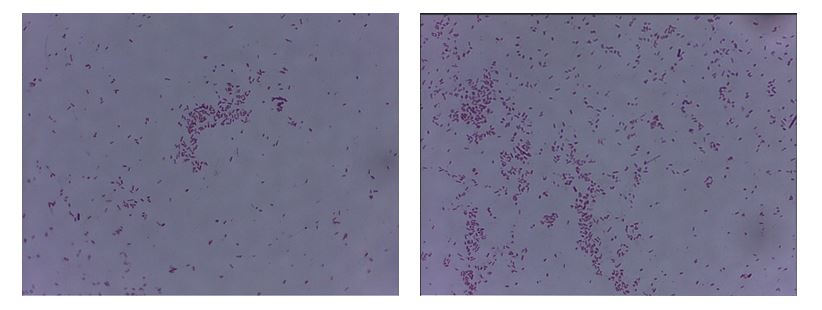  Micrographs of a Bacterial Preparation Stained by Gram Staining