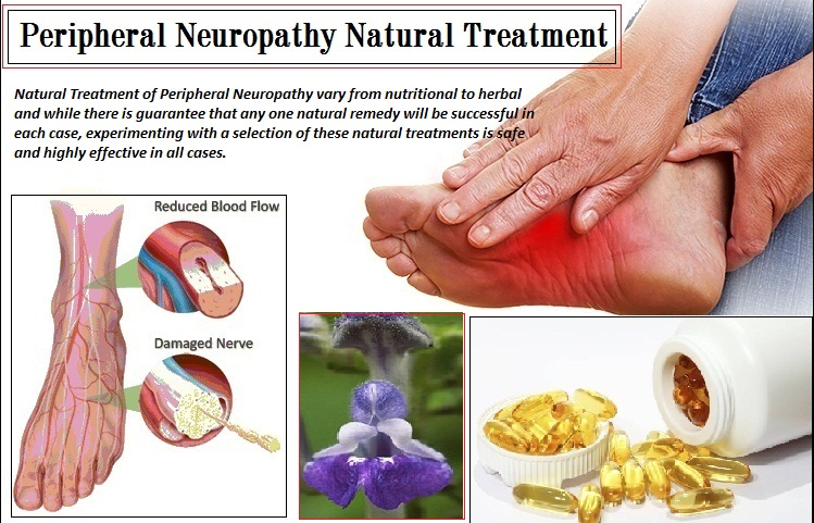 Peripheral Neuropathy Natural Treatment