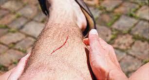 A cut wound on the calf