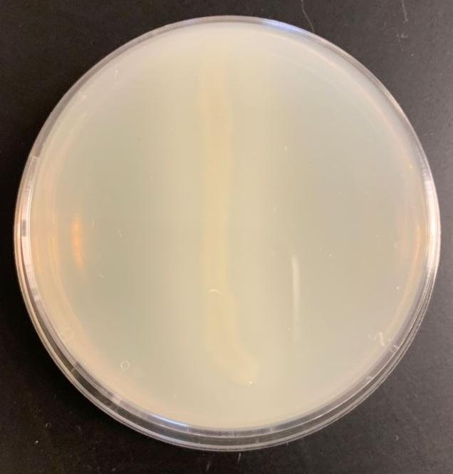 E.coli results after incubation at 370C