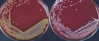 S. aureus (left) and S. epidermidis (right) - colonies on blood agar grown on 5% sheep blood agar overnight at 37 °C