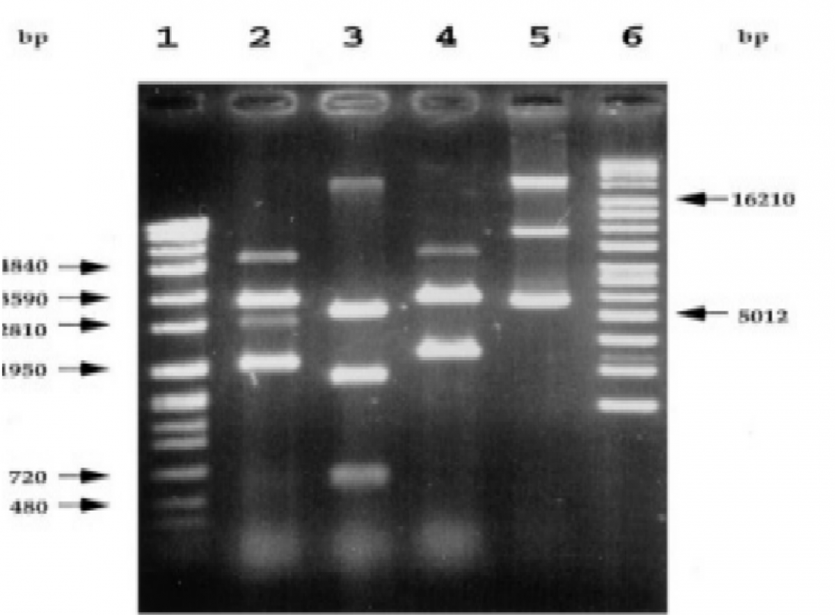 Results restriction enzyme mapping of plasmid DNA